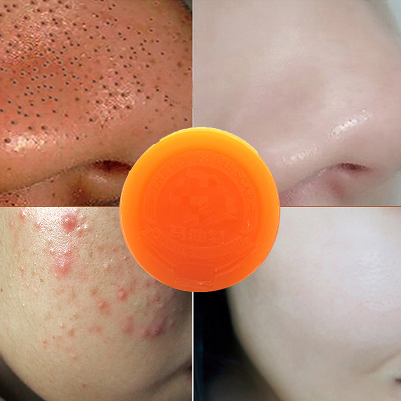 Horse Oil Handmade Soap Blackhead Acne Removal Pore Minimizer Moisturizer Skin Whitening With Foaming Net Gift Tslm2 - 1